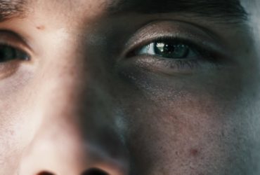 Proširene pore: što ih uzrokuje i kako ih tretirati?