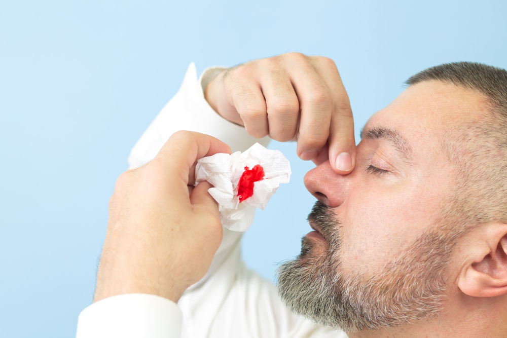 Krvarenje iz nosa kod odraslih