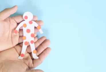 Kako prepoznati vodene kozice? Donosimo 11 ključnih znakova!